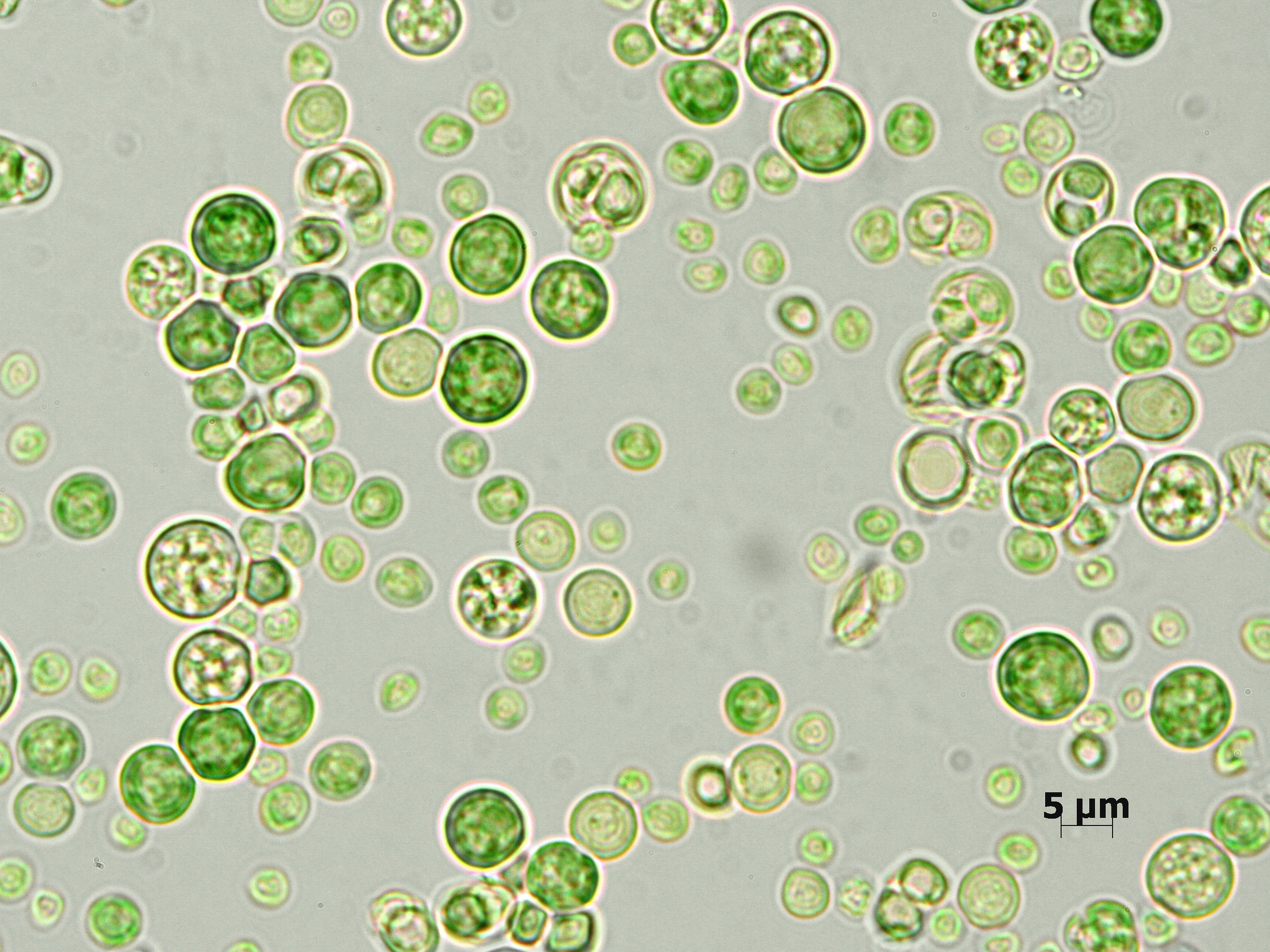 Zellen von Galdieria sulphuraria