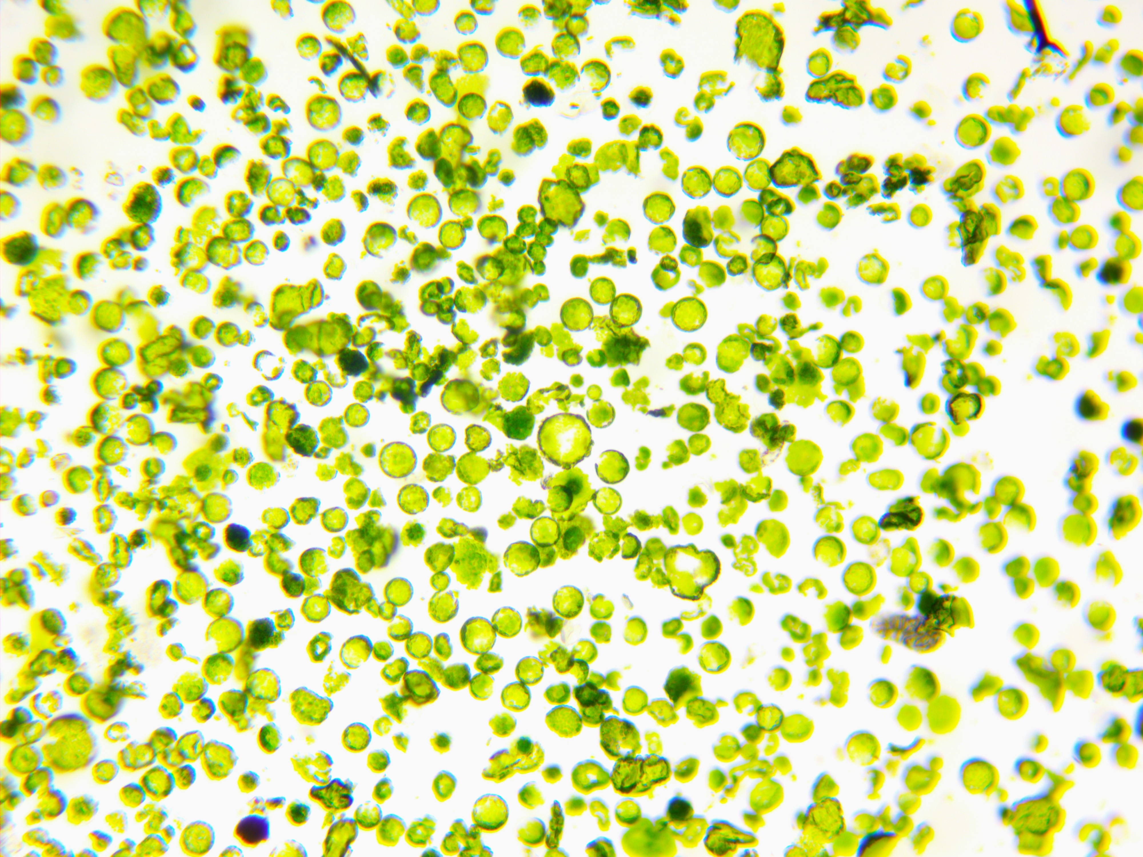 Protoplasten aus den Blättern von Nicotiana benthamiana