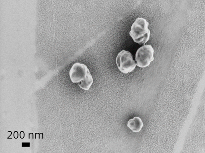 Nanoplastikpartikel im REM